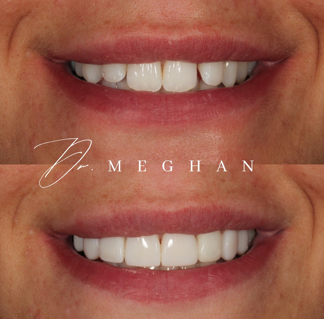 Initial Dental Consultation