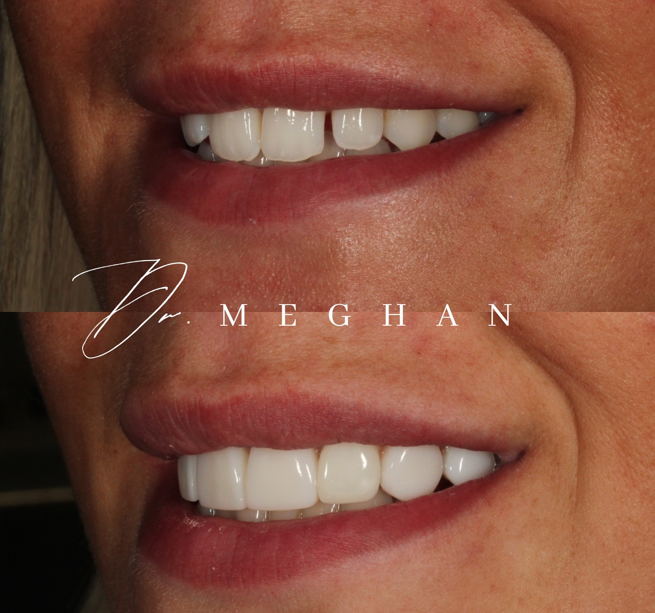 Initial Dental Consultation